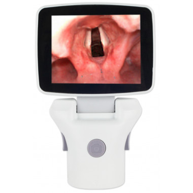 Endoscopic Video System Video Laryngoscope Visualizer