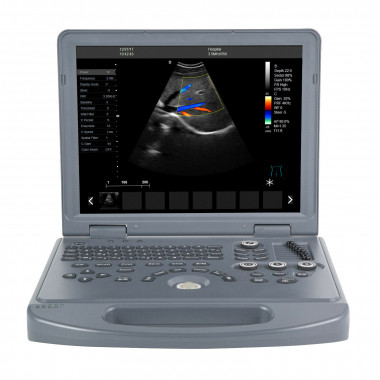 CMS1700B Portable Ultrasound Scanner Color Doppler with 4D Volumetric probe