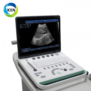 IN-A032-1 China cheap hot sale high quality notebook portable popular ultrasonic 3d b mode mobile B ultrasound Laptop machine price for sale