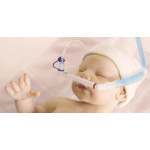 Infant Nasal CPAP